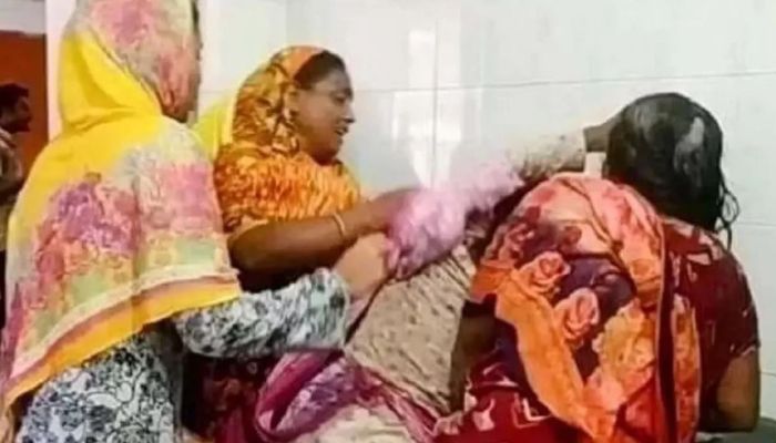 দেড় মাসেও সুস্থ হয়নি ‘মুরুব্বি-মুরুব্বি উঁহু উঁহু’ বলায় ঝলসে দেওয়া সেই কিশোরী